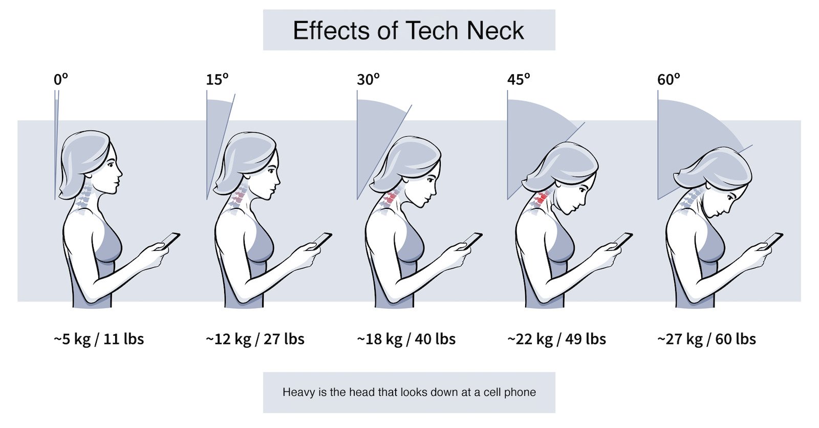 Tech Neck: Symptoms, Phone Habits & Exercises